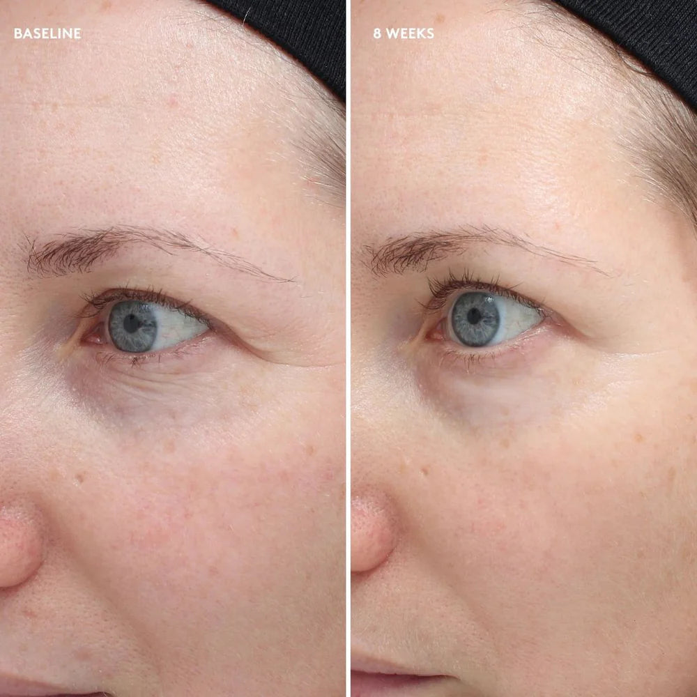 COLORESCIENCE TOTAL EYE FIRM & REPAIR CREAM